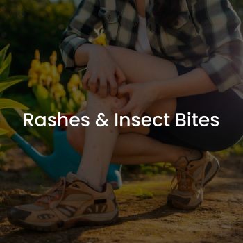 Rashes & Insect Bites Near Me at Firefly Health After Hours Care in Gallatin, TN