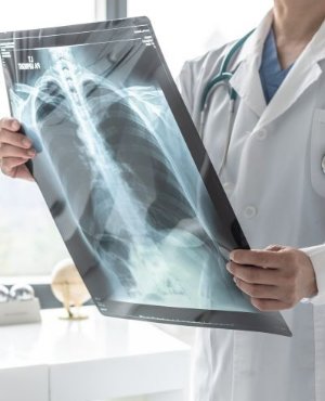 In-House X-Ray Services Near Me in Gallatin, TN