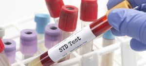 Confidential STD Testing Clinic Near Me in Gallatin, TN